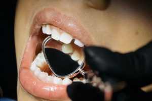 Should I Pull Out My Child's Loose Tooth